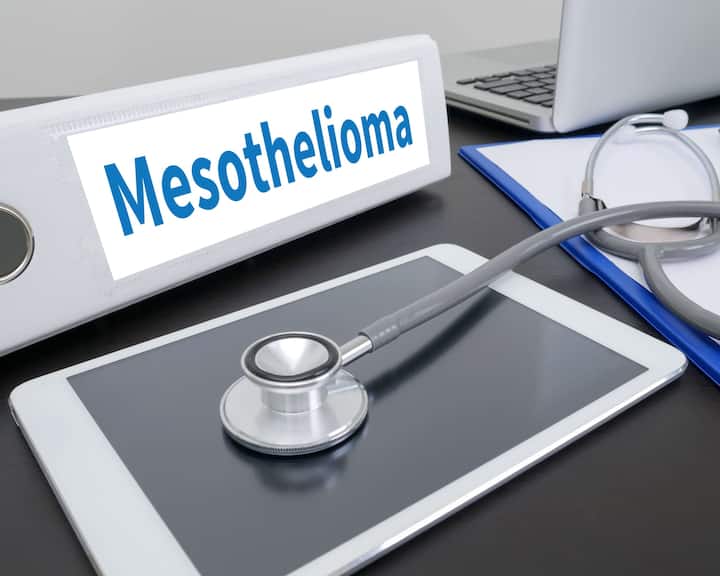 Wichita Mesothelioma Lawyer Vimeo